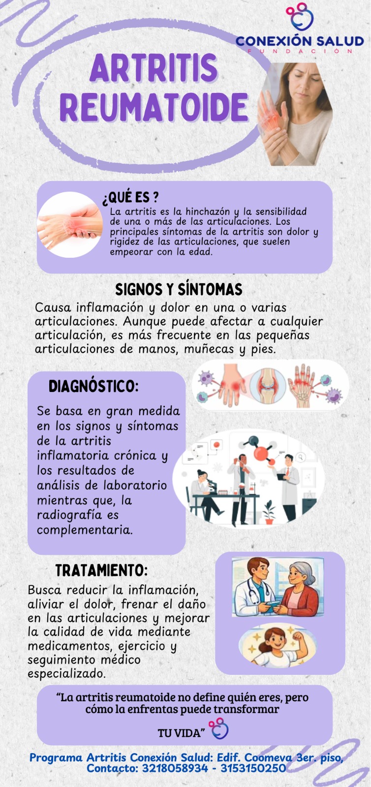 Información sobre Artritis Reumatoide